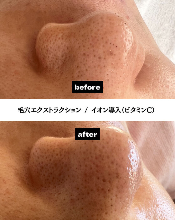 画像322