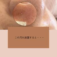 画像324