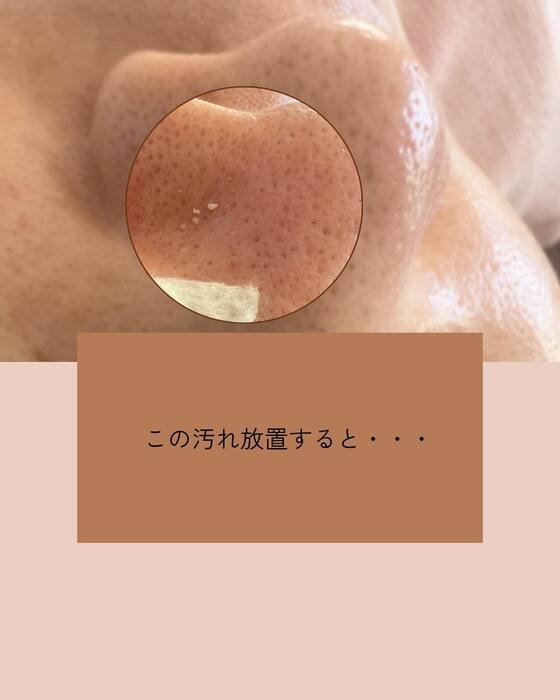 画像324