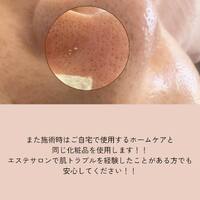 画像327