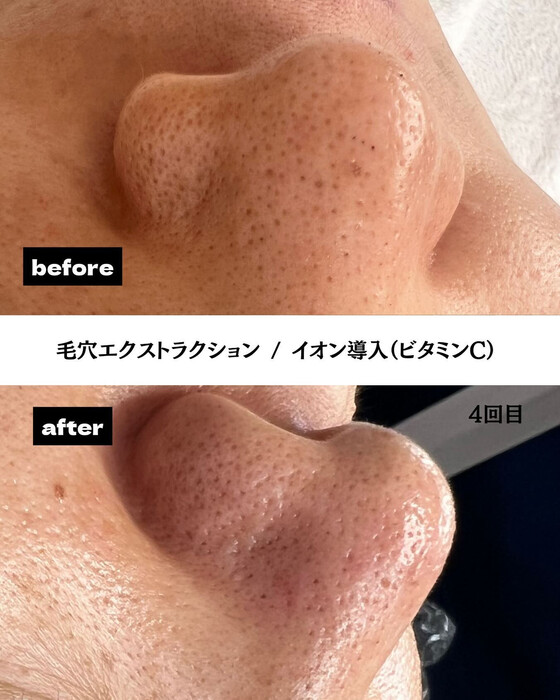 画像370