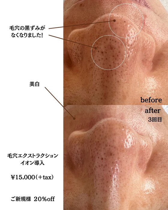 画像377