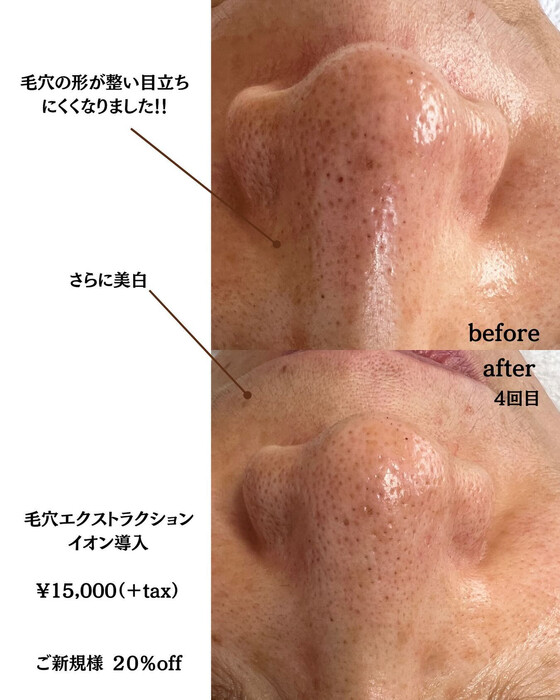 画像379