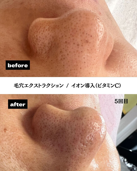 画像385